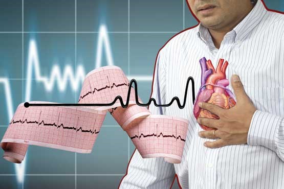 فشار خون و افسردگی خطر سکته قلبی را افزایش می دهد