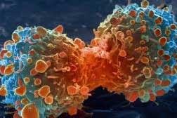 مبارزه با سلول‌های سرطانی با ترکیب دو نوع ویروس