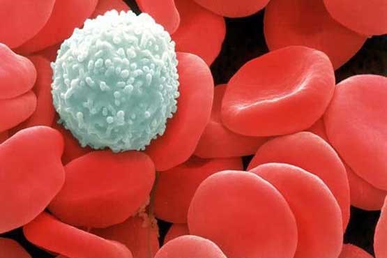 ژن متوقف کننده سرطان خون کشف شد