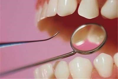 تصویر این 10 خوراکی شما را از رفتن به دندان پزشک بی نیاز می کنند
