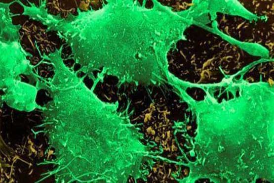 ژن درمانی موثر سلول‌های سرطانی با نانو حامل