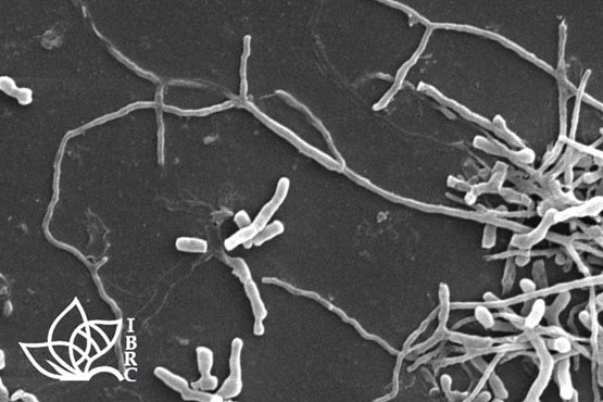 شناسایی یک باکتری رشته ای جدید در ایران