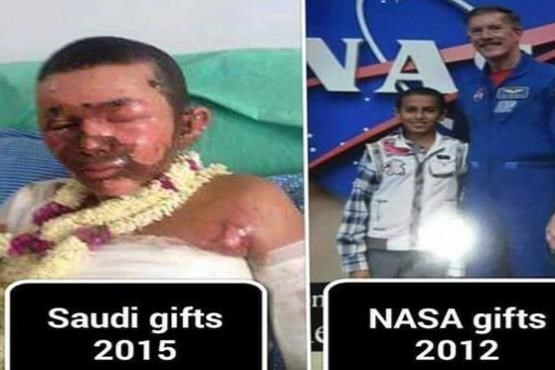 رژیم آل سعود کودک یمنی برنده جایزه ناسا را سوزاند!