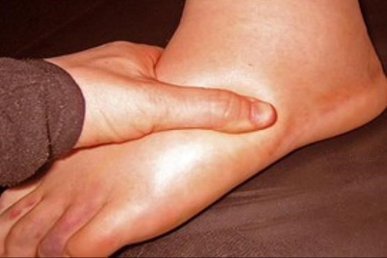 چگونه پف یا ورم دست و پا را درمان کنیم ؟