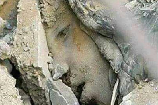 کودکی که زیر بمباران سعودی ها دفن شد + عکس