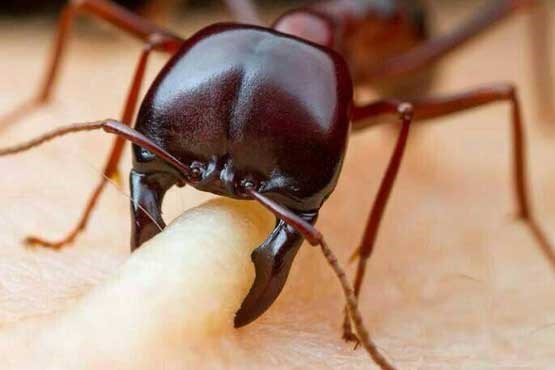لحظه گاز گرفتن مورچه از انسان + عکس