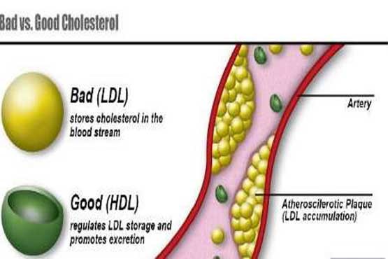 راه های موثر کاهش میزان کلسترول