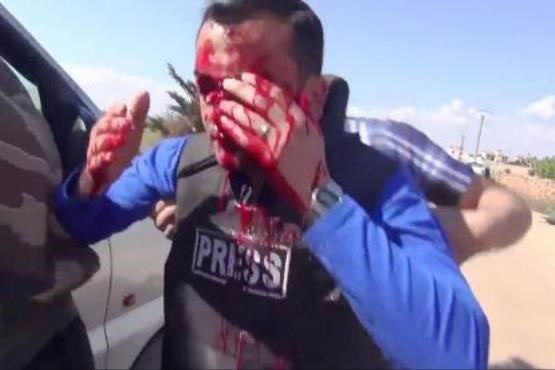 ترکش خوردن خبرنگار هنگام گزارش زنده