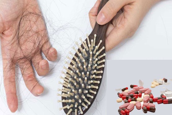 ریزش مو؛ عوامل و درمان