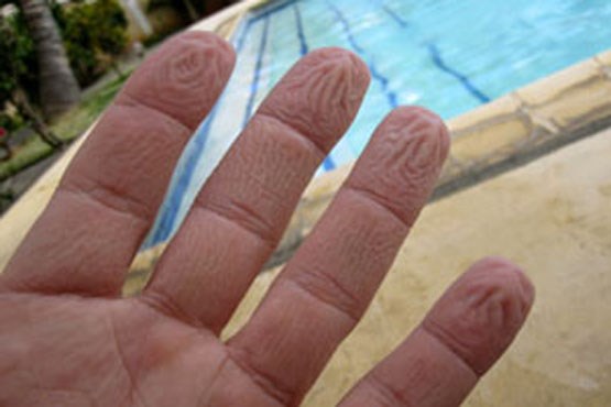 راز  «چروک شدن انگشت‌ها» در آب