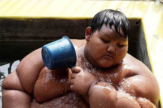 چاق‌ ترین پسر دنیا + عکس