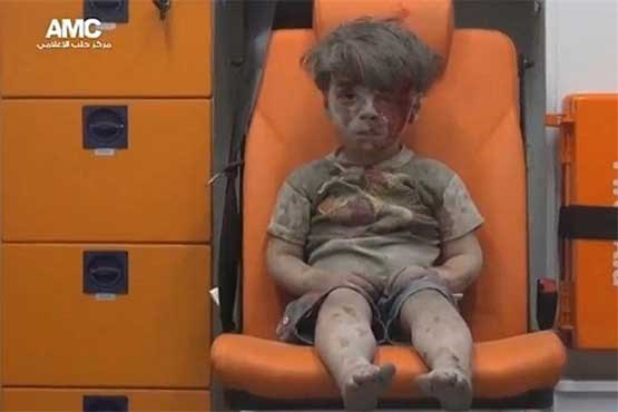 تصویر تکان‌دهنده کودک خون‌آلود سوری در حلب + عکس