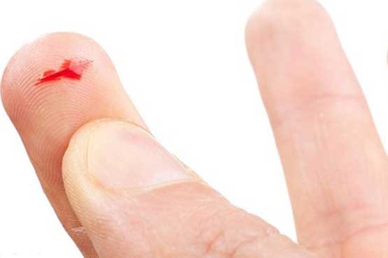 چرا «دردِ کاغذ» وحشتناک است؟