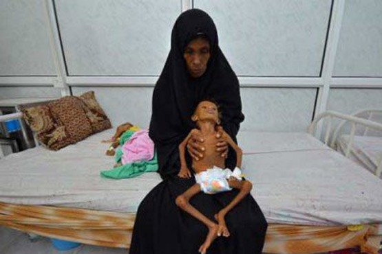 یونیسف: ۲ میلیون کودک یمنی از تحصیل محرومند