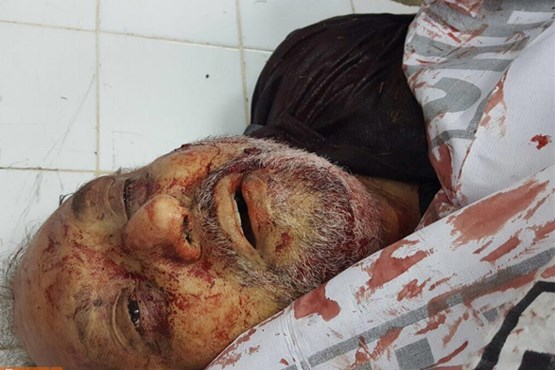 حمله تروریستی به مجلس عزای حسینی در کراچی +عکس