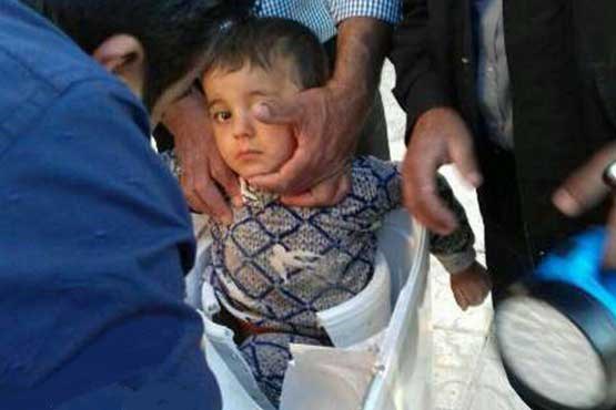 کودک گرفتار در ماشین لباسشویی +عکس