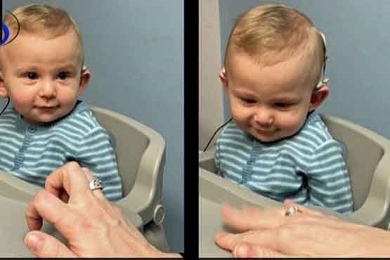 واکنش جالب کودک ناشنوا بعد از شنیدن صدای مادرش
