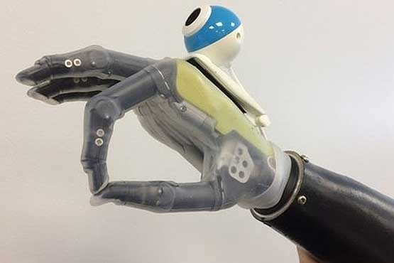 ساخت دست مصنوعی همراه با دوربین