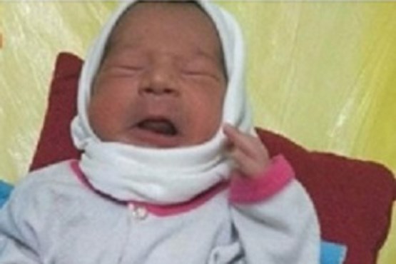 تولد نوزاد با 24 انگشت در گناباد + عکس