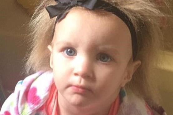 دختربچه 2 ساله، صاحب عجیب ترین موهای دنیا! +تصاویر