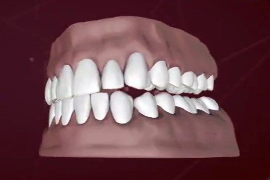 بهترین و بدترین ها برای دندان