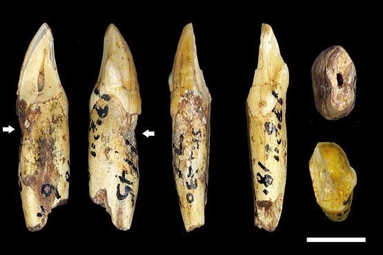 داستان چند هزار ساله درد دندان