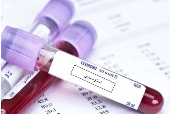 آزمایش بررسی میزان سطح هورمون تستوسترون در خون زنان و مردان