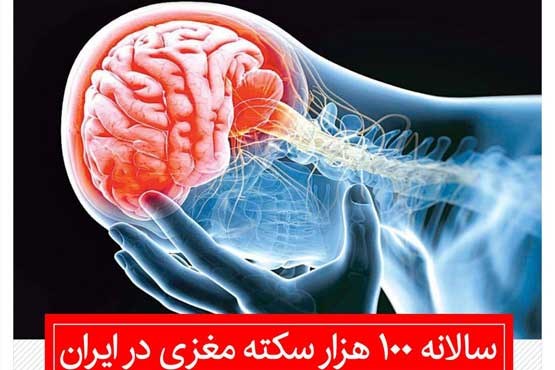 سکته مغزی، دومین عامل مرگ و میر ایرانیان