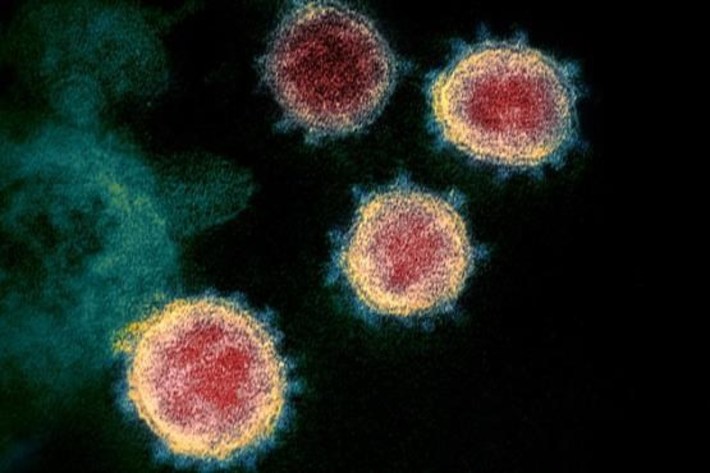 یک متخصص بیماری های عفونی می گوید اگر بهداشت فردی و نکات ریز در رابطه با پیشگیری رعایت شود نگرانی در رابطه با مبتلا شدن به ویروس کرونا معنایی ندارد.