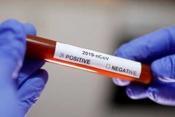 وزارت بهداشت چین بامداد دوشنبه اعلام کرد: شمار قربانیان ویروس کرونای جدید در این کشور به ۲ هزار و ۵۹۲تن افزایش یافته است.