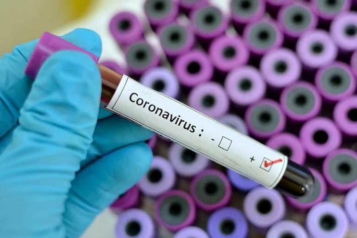 سازمان بهداشت جهانی اعلام کرد، تعداد تایید شده مبتلایان به کروناویروس در سراسر جهان به ۶۳۴ هزار و ۸۳۵ تن رسید که ۲۹ هزار و ۹۵۷ تن از آنها جان خود را بر اثر ابتلا به این ویروس از دست دادند.