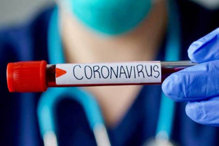 سخنگوی وزارت بهداشت، درمان و آموزش پزشکی کشور از شناسایی 3186 نفر مبتلای جدید به ویروس کرونا در بیست و چهار ساعت گذشته خبر داد.
