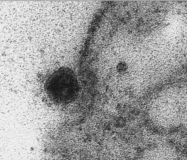 لحظه ورود کووید ۱۹ به سلول ثبت شد (+عکس) لحظه ورود کووید ۱۹ به سلول ثبت شد (+عکس)