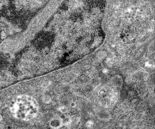 لحظه ورود کووید ۱۹ به سلول ثبت شد (+عکس) لحظه ورود کووید ۱۹ به سلول ثبت شد (+عکس)