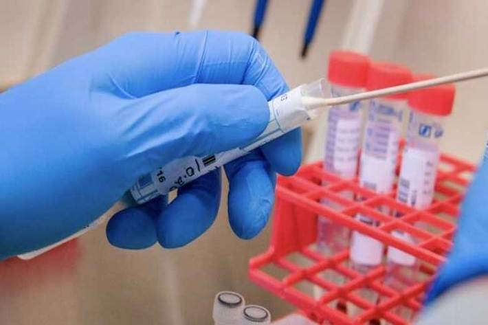 یک شرکت داروسازی چندملیتی اعلام کرده در سه ماهه سوم ۲۰۲۰ آزمایش های بالینی یک داروی بالقوه برای درمان ویروس کرونا را آغاز می کند.