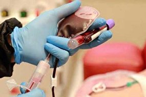 مدیرعامل سازمان انتقال خون: پروژه جمع آوری پلاسمای خون بهبودیافتگان از فردا شروع می شود (+عکس)