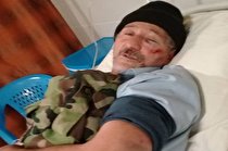 ضرب و شتم جنگلبانان از سوی قاچاقچیان چوب در تالش ضرب و شتم جنگلبانان از سوی قاچاقچیان چوب در تالش