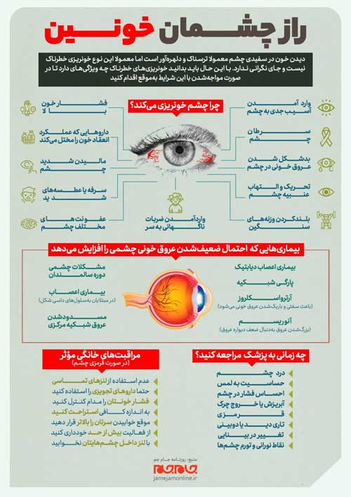 راز چشمان خونین (اینفوگرافیک)