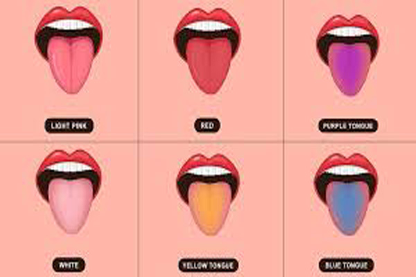زبان شما چه رنگی است؟