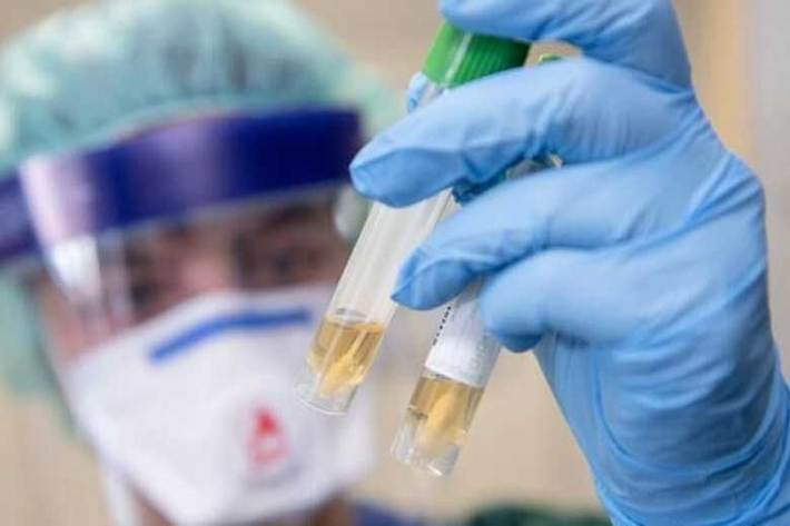 رسانه‌ های آلمان گزارش دادند که پژوهشگران شهر «براون‌شویگ» در این کشور توانسته‌اند به پادتن‌ هایی (آنتی‌ بادی‌) برسند که می‌توانند مانع ویروس کرونا برای ورود به سلول‌ های انسانی شوند.