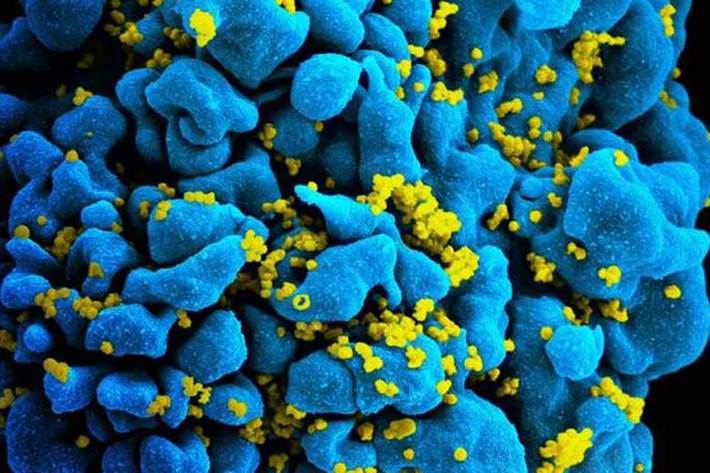 پژوهشگران «دانشگاه استنفورد» (Stanford University) در بررسی جدید خود نشان دادند که امکان درمان ایمن و بی‌خطر ایدز، با کمک یک مولکول نادر وجود خواهد داشت.