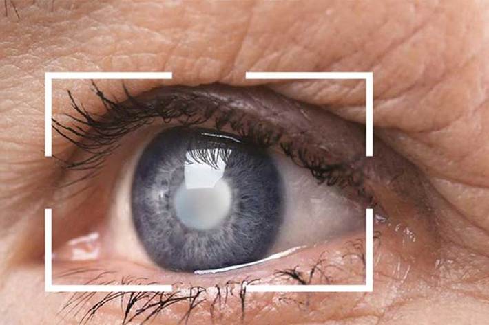 فوق تخصص شبکیه گفت: اغلب افرادی که دچار بیماری‌ های چشمی هستند در سنین بالا قرار دارند و نباید از حضور در مراکز درمانی چشم پزشکی به دلیل بیماری کرونا خودداری کرد.