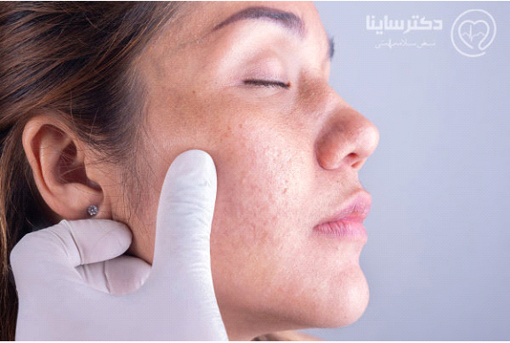 با بهترین دکتر های پوست و مو به صورت آنلاین صحبت کنید! با بهترین دکتر های پوست و مو به صورت آنلاین صحبت کنید!