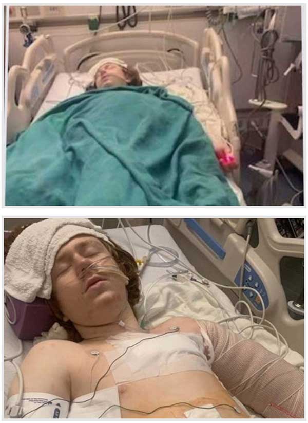 شلیک چندباره پلیس آمریکا به نوجوان اوتیسمی (+عکس)