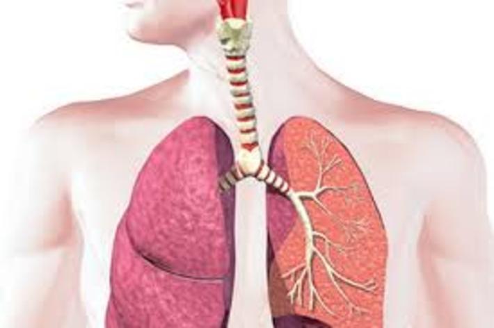 خس خس سینه صدای بلند با حالت سوت است و در هنگام نفس کشیدن به وجود می‌آید. خس خس معمولا در تنفس بازدم  ایجاد می شود اما گاهی اوقات می تواند به تنفس دم نیز مرتبط باشد.