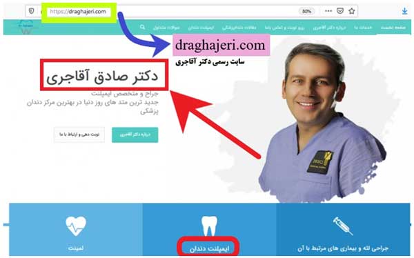 از سیر تا پیاز ایمپلنت دندان !!