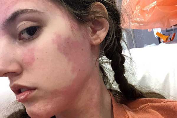 دختری که غذا را از طریق قلبش می‌خورد! (+عکس)