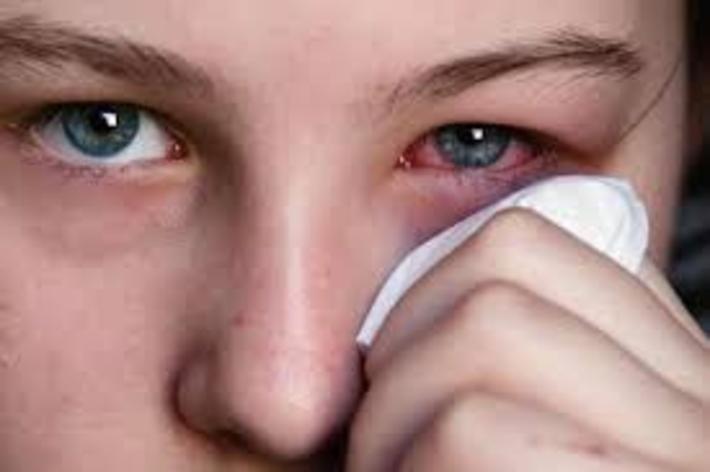 چه عواملی باعث ایجاد ترشح و عفونت چشم می شود
ترشحات چشم یا 