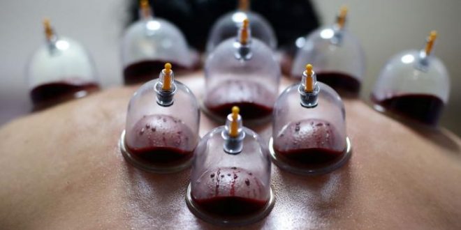 علائم نیاز بدن به حجامت در پاییز