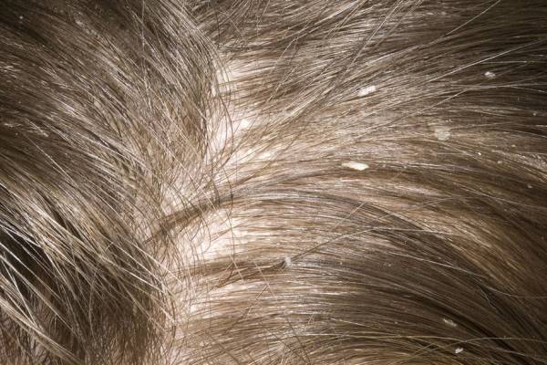 خواص درمانی و زیبایی پوست انار و جوشانده پوست انار